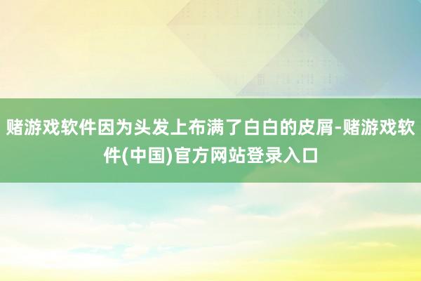 赌游戏软件因为头发上布满了白白的皮屑-赌游戏软件(中国)官方网站登录入口